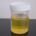 virginia welfare drug testing drug test Source http://stopthedrugwar.org/files/imagecache/300px/800px-Urine_sample_8.jpg
