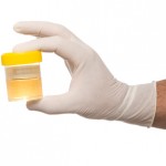 Study Student Drug Testing Programs Linked To Spikes In Hard Drug Use Source http://ssdp.org/assets/2011/12/urine-drug-test-public-150x150.jpg