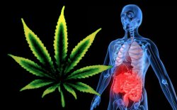 Cannabis for IBS Relief