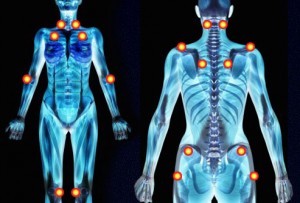 Title: Fibromyalgia and Cannabis: Helping My Mother See Green, Source:http://politicalblindspot.org/wp-content/uploads/2013/06/getty_rm_photo_of_skeletal_images.jpg