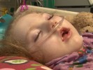 Mother Says Medical Cannabis Cut Daughter’s Seizures 95%