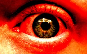 Red Eyes and Marijuana – Why, Why Me and What to Do About It