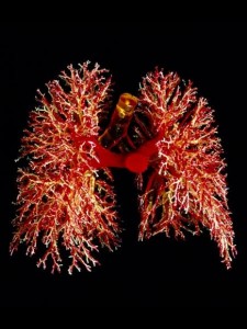 Cannabis and Lung Cancer | source: http://alchymista.tumblr.com/post/17683408460/resin-cast-of-the-lungs-displaying-the-branching