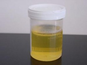 Virginia Welfare Drug Testing Bill Moving