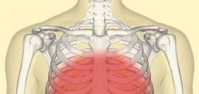 THC Pills: A New Rx for Chest Pain?